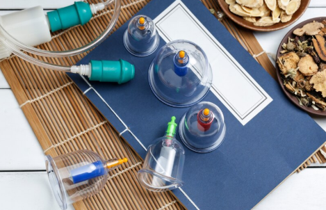 Glass Hijama cups placed on the skin to relieve pain and improve blood circulation