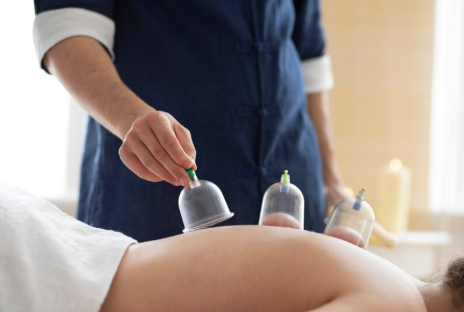 Hijama therapy session showing suction cups on a patient’s back used for pain relief, stress reduction, and detoxification through traditional cupping.
