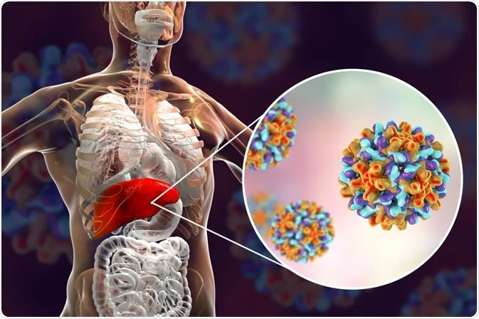 Illustration showing liver with labels "Hepatitis B" and "Hepatitis C" — Hepatitis B is manageable with treatment, while Hepatitis C is often curable with modern antiviral medication.